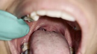 Intimate uvula exploration